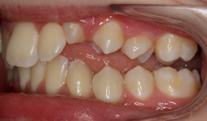 before Image
