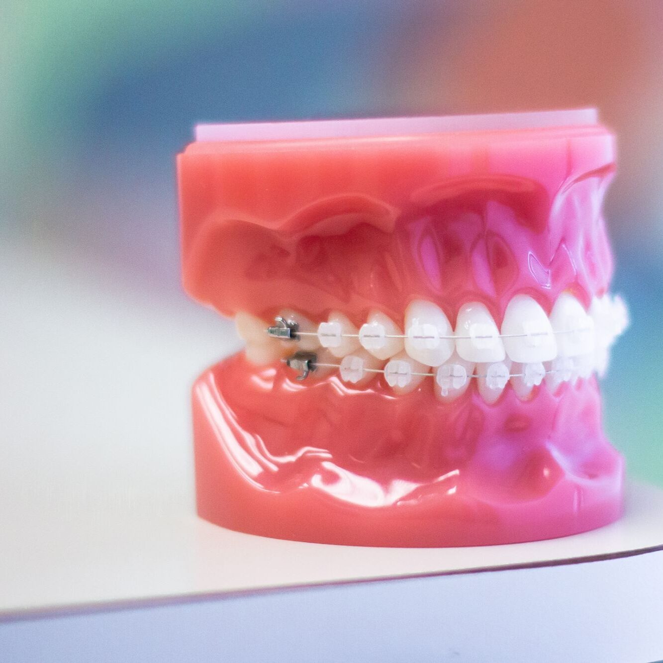 clear braces germantown