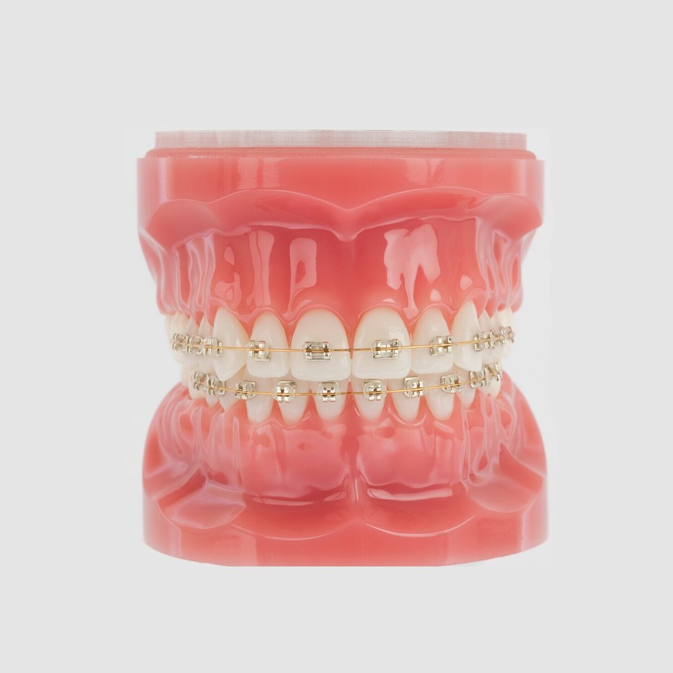 metal braces germantown