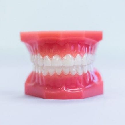 invisalign